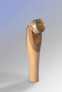 orthotics, prosthesis, prosthetic leg, prosthetic foot, robot hand, below knee prosthesis, green bay wi