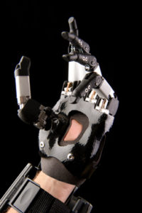 accessprosthetics.com, prosthetic foot, bionic arm, below knee prosthesis, access prosthetics, green bay