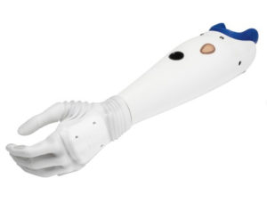 Michelangelo artificial arm,artificial hands, access prosthetics, prosthetic leg, prosthetics, prosthetic arm, ankle foot orthosis, plantar fasciitis insoles, custom orthotics, best insoles for plantar fasciitis, orthotics for plantar fasciitis, custom insoles, best inserts for plantar fasciitis, orthotic inserts, foot orthotics, orthotics for flat feet, orthotic insoles, prosthetic foot, inserts for flat feet, custom orthotic insoles, custom orthotics near me, foot inserts, arch supports inserts, orthotic insoles near me, walkfit orthotics,